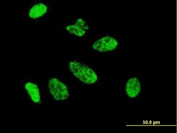 Monoclonal Mouse anti-Human CDX1 Antibody (clone 2D8, IF, WB)
