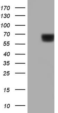 PKM2 Antibody (clone 13H1)