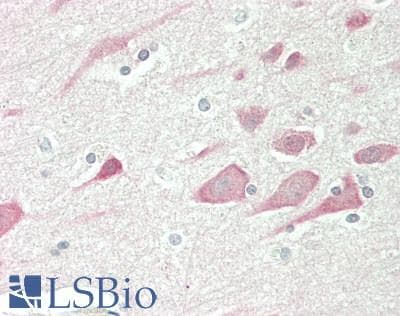 IHC-plus™ Polyclonal Rabbit anti-Human MAPT / Tau Antibody (C-Terminus, IHC, IF, WB)