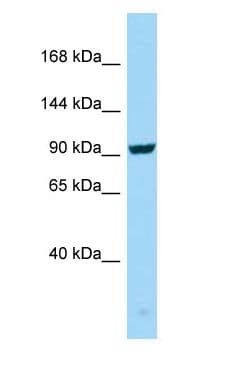 PathPlus™ SEZ6 / SEZ-6 Antibody (aa826-875)