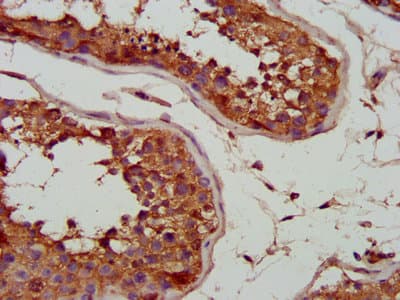 ANT2 / SLC25A5 Antibody