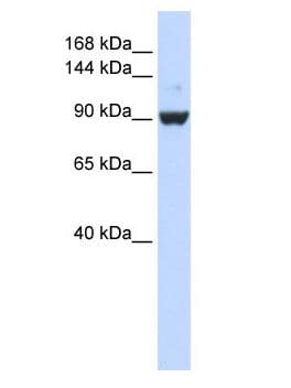 DHX34 Antibody (aa331-380)
