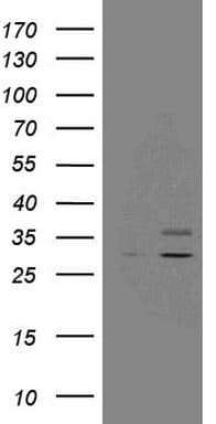 SDHB Antibody (clone OTI2A1)