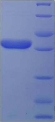 Human DENR / Density Regulated Protein (Recombinant His-SUMO)