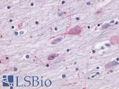 PathPlus™ Polyclonal Rabbit anti-Human MTNR1A / Melatonin Receptor 1a Antibody (Cytoplasmic Domain, IHC)