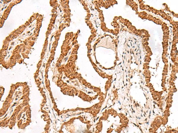 FER Antibody