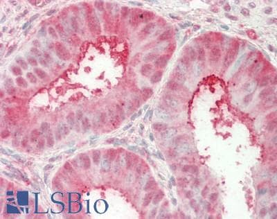 IHC-plus™ PSMA5 Antibody