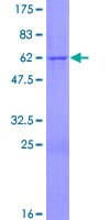 Human PNPO Protein (Recombinant GST)