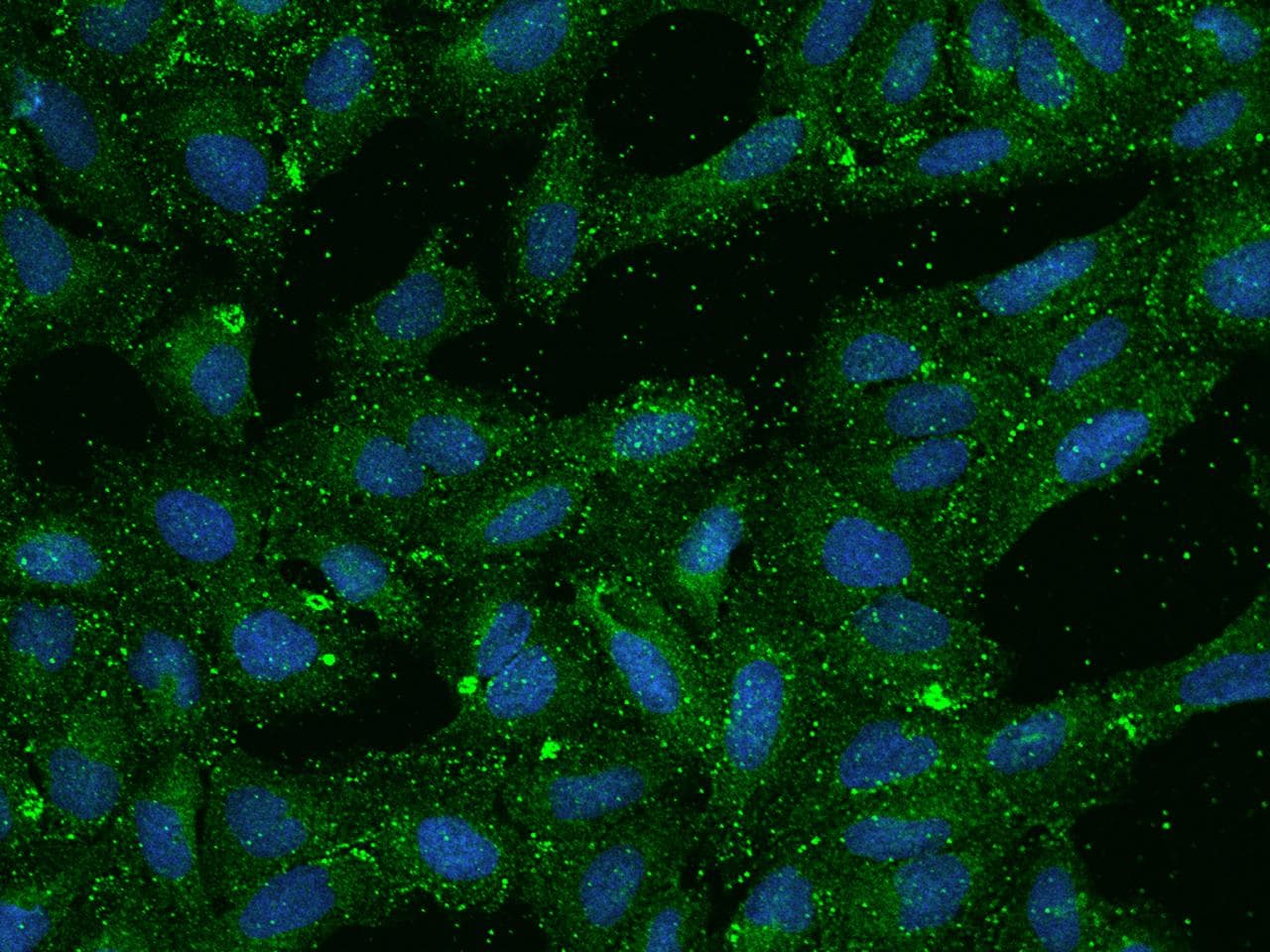 SCARB1 / SR-BI Antibody
