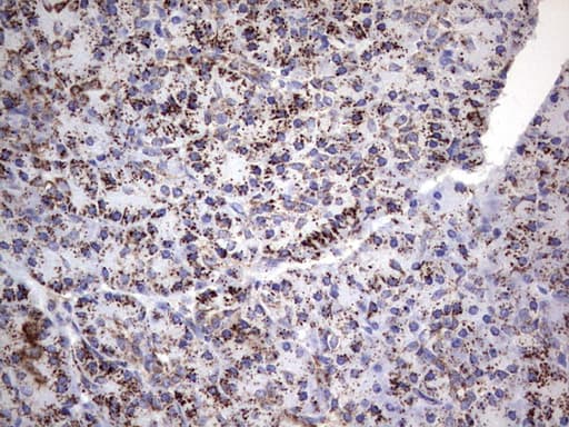 PIK3CD / PI3K Delta Antibody (aa286-610, clone OTI1D11)