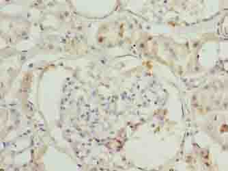 ILVBL Antibody