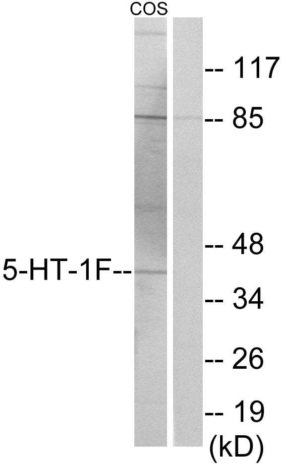 Polyclonal Rabbit anti-Human HTR1F / 5-HT1F Receptor Antibody (WB)
