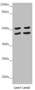 HAUS8 Antibody