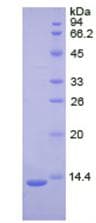 Human PLAT / TPA Protein (Recombinant His)