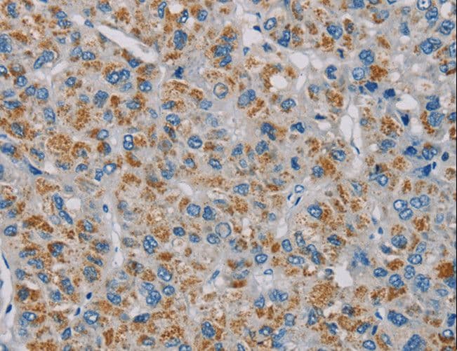 PNLIP / PL / Pancreatic Lipase Antibody