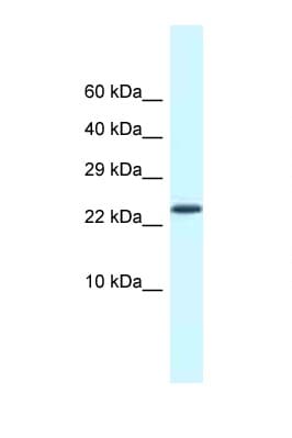 CSDC2 Antibody (aa21-70)