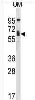 TCF3 / E2A Antibody (aa506-534)