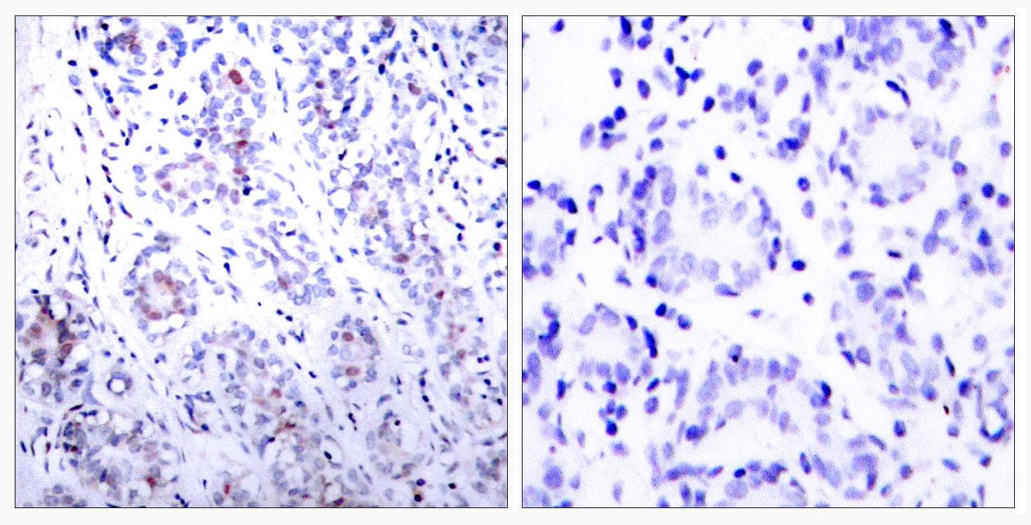 Polyclonal Rabbit anti-Human STAT3 Antibody (p727, IHC, WB)