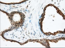ACAT2 Antibody (clone OTI5A2)