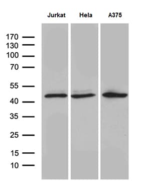 Monoclonal Mouse anti-Human NFKBIE / IKB Epsilon Antibody (clone OTI6D8, Carrier-free, WB)