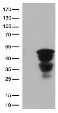 CTSL / Cathepsin L Antibody (aa114-333, clone OTI6D5, Carrier-free)