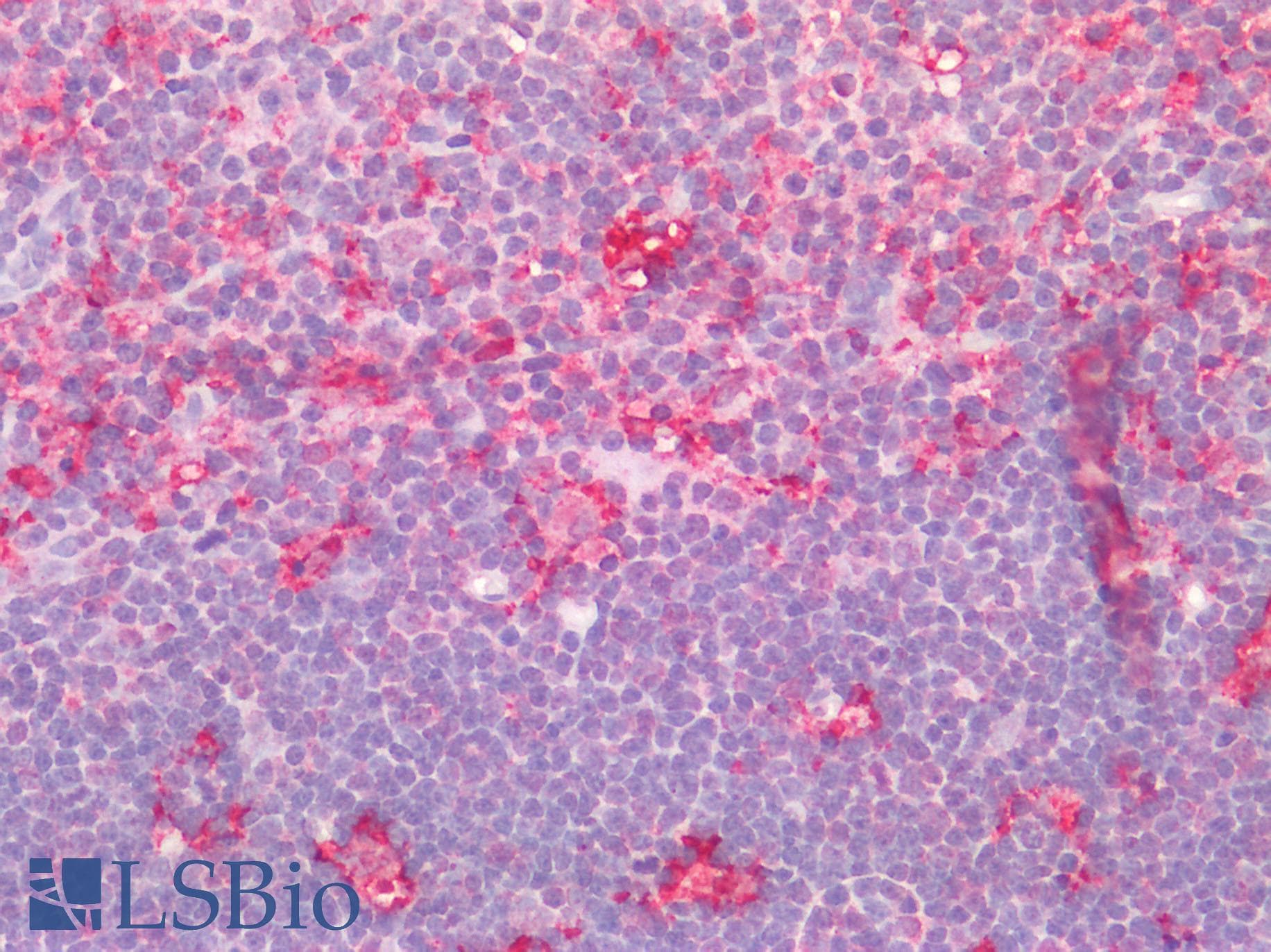 IHC-plus™ AIF1 / IBA1 Antibody (C-terminal domain of human)