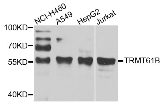 Polyclonal Rabbit anti-Human TRMT61B Antibody (WB)