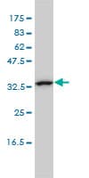 IHC-plus™ CAB39L Antibody (clone 3B11-1A4)