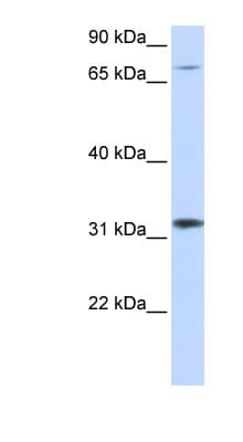 Polyclonal Rabbit anti-Human ZNF799 Antibody (aa261-310, WB)