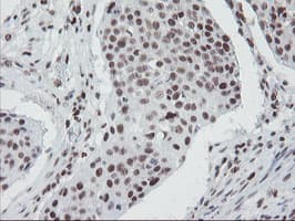 TPRKB Antibody (clone OTI3H3)