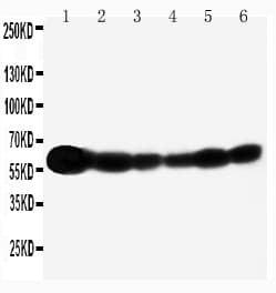 Polyclonal Rabbit anti-Human p66 / SHC Antibody (aa424-440, IHC, WB)