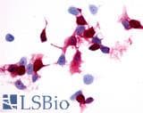 IHC-plus™ Polyclonal Rabbit anti-Human PTGER4 / EP4 Antibody (Extracellular Domain, IHC)