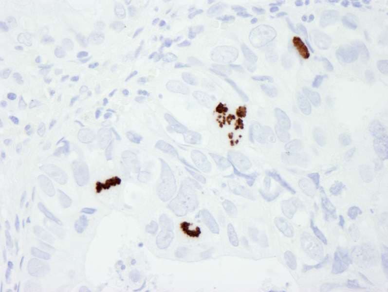 HIST1H3A Antibody (phospho-Ser10)