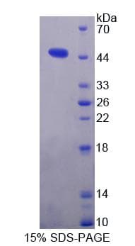 Human GSN / Gelsolin Protein (Recombinant His, N-Terminal)