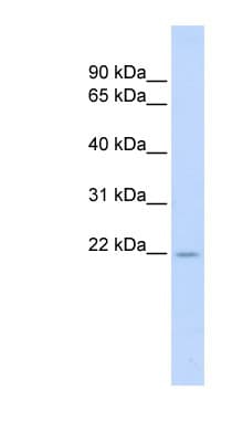 Polyclonal Rabbit anti-Human TNFSF18 / GITRL Antibody (aa108-157, WB)