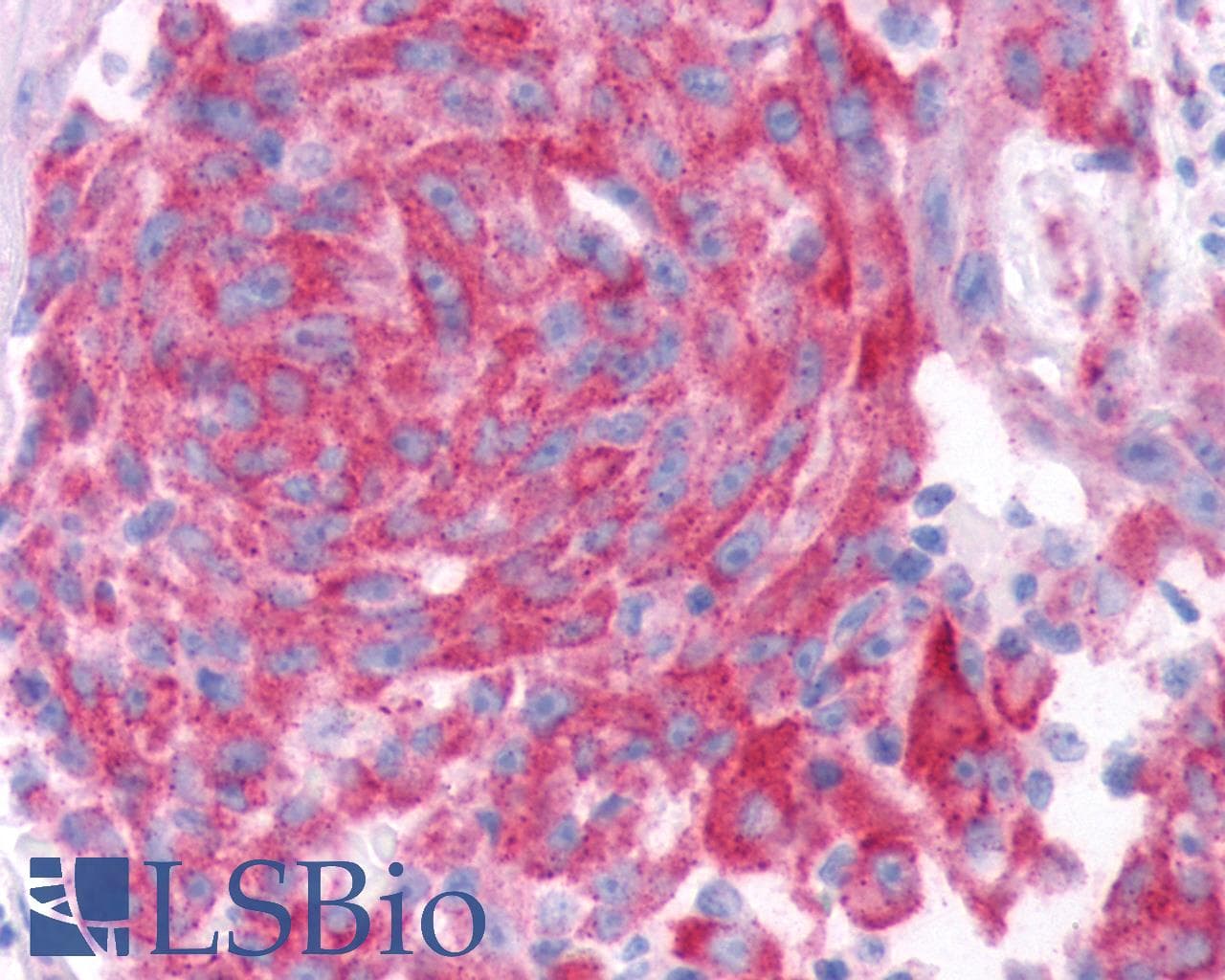 PathPlus™ TAS1R2 / T1R2 Antibody (N-Terminus)