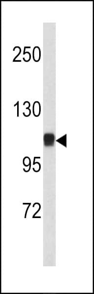 IHC-plus™ Polyclonal Rabbit anti-Human CTNNA1 / Catenin Alpha-1 Antibody (aa30-59, IHC, WB)
