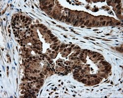 Monoclonal Mouse anti-Human ACLY / ATP Citrate Lyase Antibody (clone 3G8, Carrier-free, IHC, IF, WB)