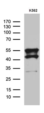 Monoclonal Mouse anti-Human VRK2 Antibody (clone OTI8H5, Carrier-free, aa301-486, WB)
