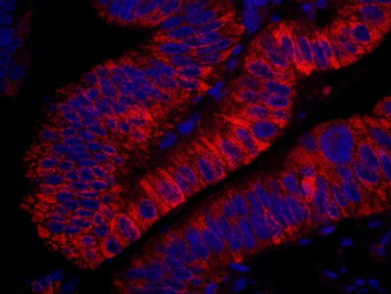Polyclonal Rabbit anti-Human ARHGEF5 Antibody (aa600-650, IHC, IF)