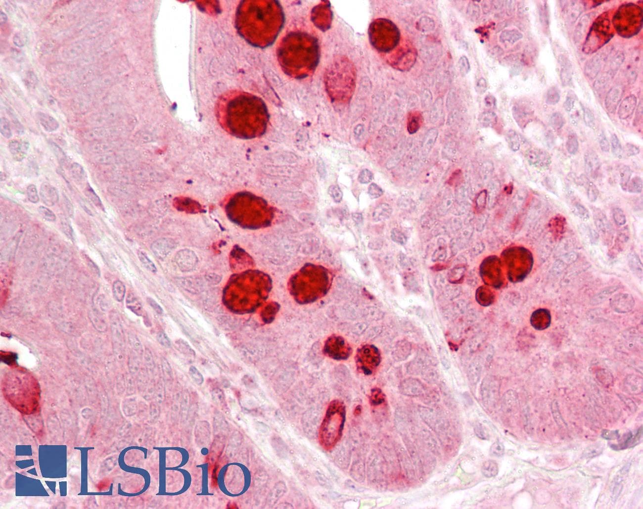 IHC-plus™ AGO1 / EIF2C Antibody (aa382-395)