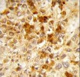 PEX2 / PAF-1 Antibody (aa165-194)