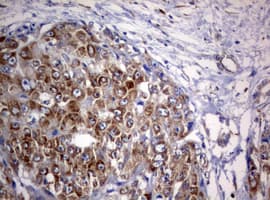 Monoclonal Mouse anti-Human PIK3C2A Antibody (clone OTI11D6, aa230-560, IHC, WB)
