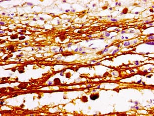 MAZ Antibody