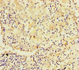 Polyclonal Rabbit anti-Human TMPRSS11B Antibody