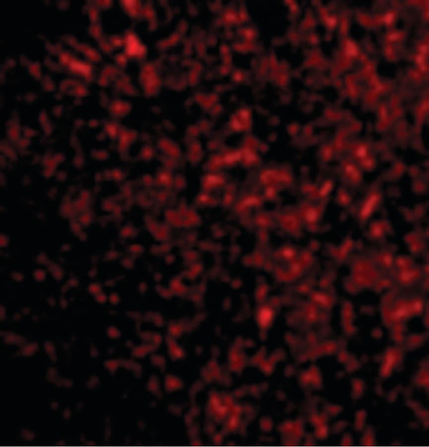 IHC-plus™ Polyclonal Rabbit anti-Human TSAP6 / STEAP3 Antibody (IHC, IF, WB)
