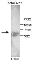 AKT2 Antibody