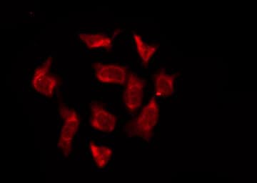 OR6T1 Antibody