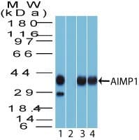 AIMP1 / EMAP II Antibody (aa260-310)