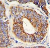 Polyclonal Rabbit anti-Human DNAJA1 / HDJ2 Antibody (aa294-323, IHC, WB)